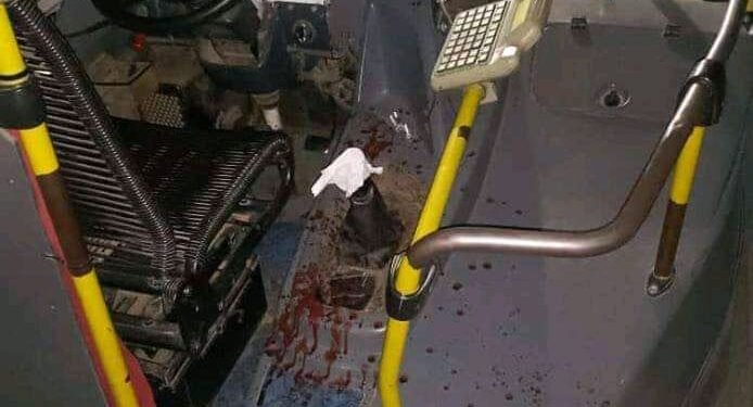 EN EL DIA DEL COLECTIVERO , CHOFER DE LA 391  LE CORTARON LOS DEDOS .