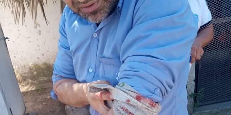 OTRO CHOFER DE COLECTIVOS FUE AGREDIDO EN MENOS DE DOS DIAS.