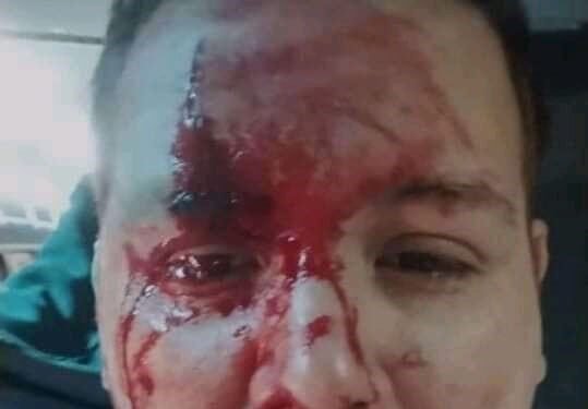 AGREDEN A CHOFER DE LA LINEA 338 TALP.