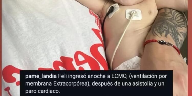 SOMOS TODOS FELIPE  , NECESITA UN CORAZON ESTA EN LISTA DE ESPERA EN EL INCUCAI .