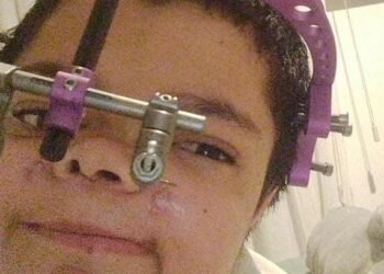 SIMONA NECESITA DE NUESTRA SOLIDARIDAD .