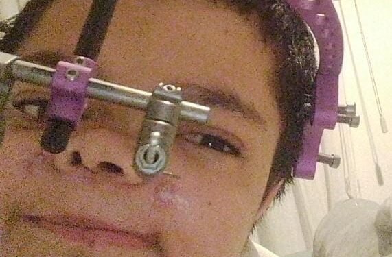 SIMONA NECESITA DE NUESTRA SOLIDARIDAD .