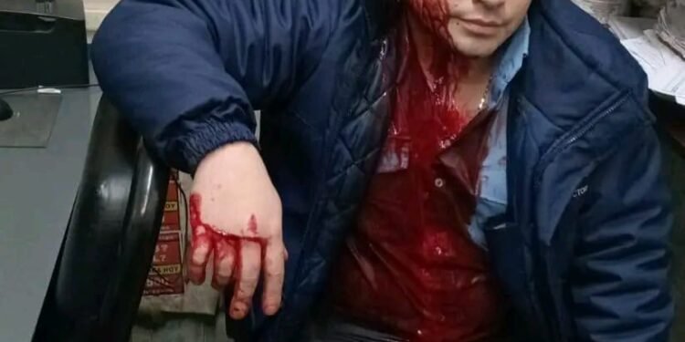 ULTIMO MOMENTO LA MATANZA : AGREDEN A CHOFER DE LA LINEA 126 .